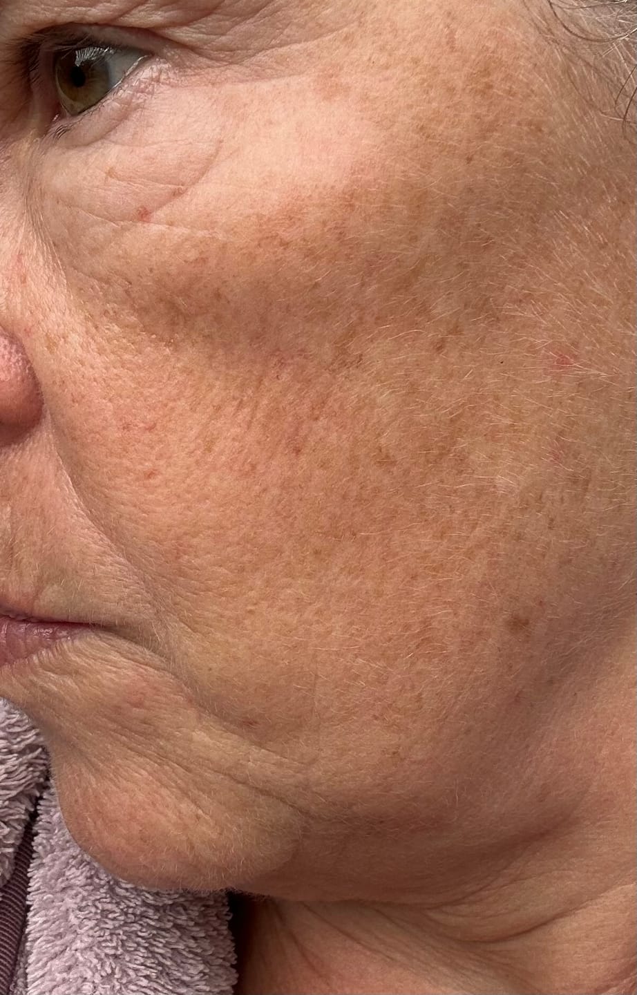 Customer photo review of Serum Sample Duo (FREE)