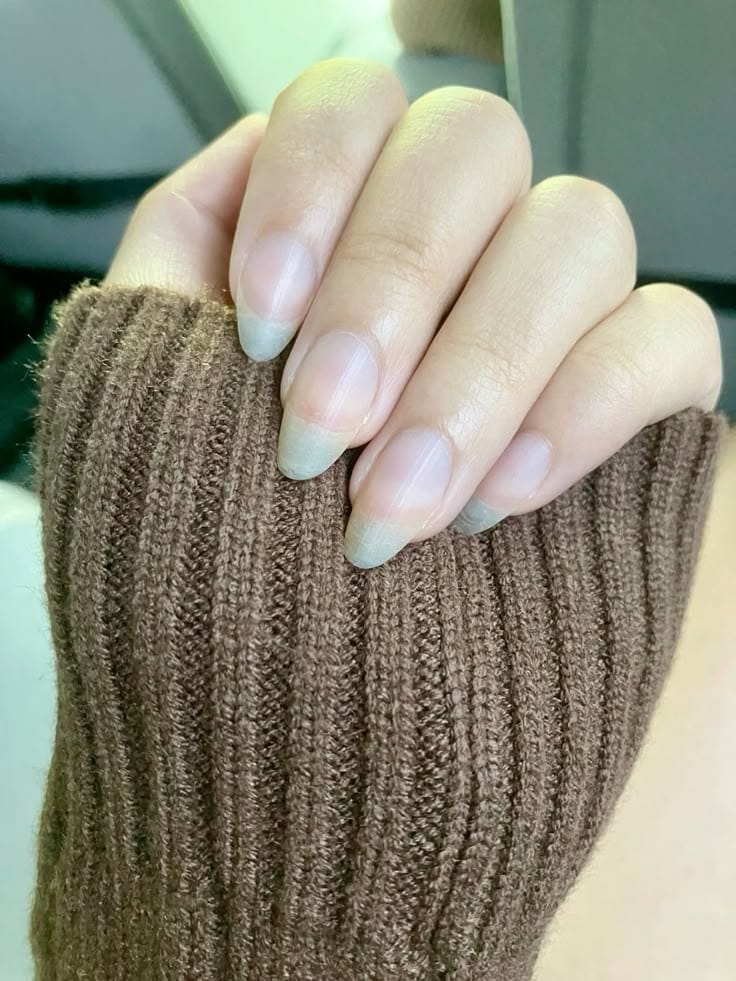 Customer photo review of עט השמן של NOVELA לשיקום הציפורן והעור