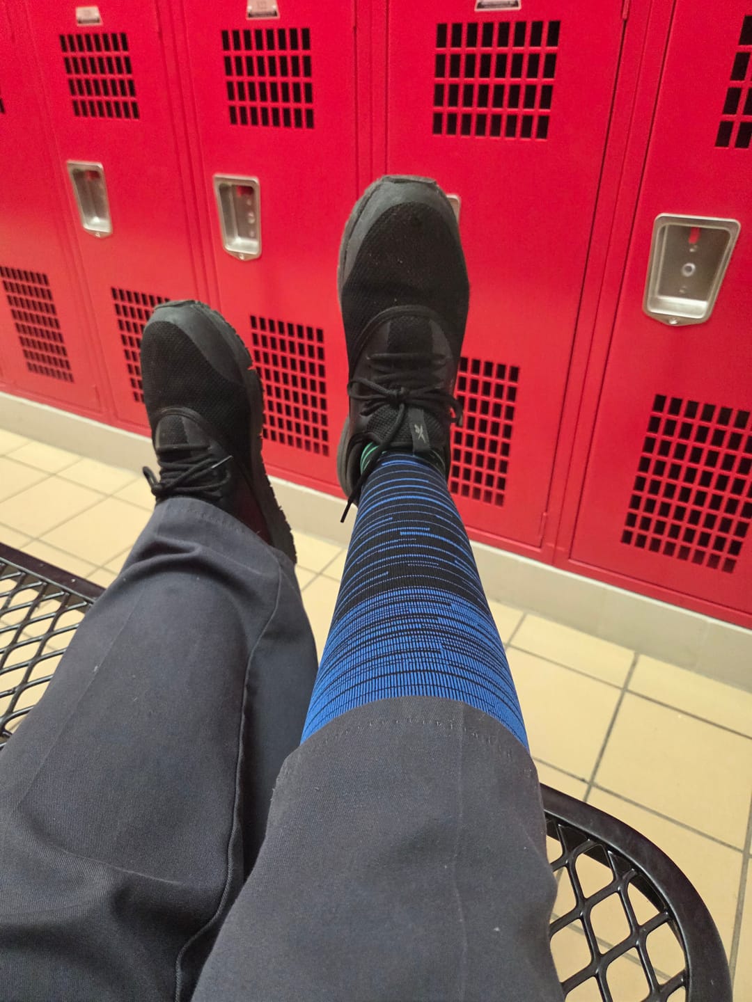 Customer photo review of The Step by Step Guide To Transforming Your Leg Health