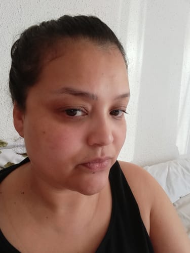 Customer photo review of The Super Glo Hydro Boost Jelly Moisturiser