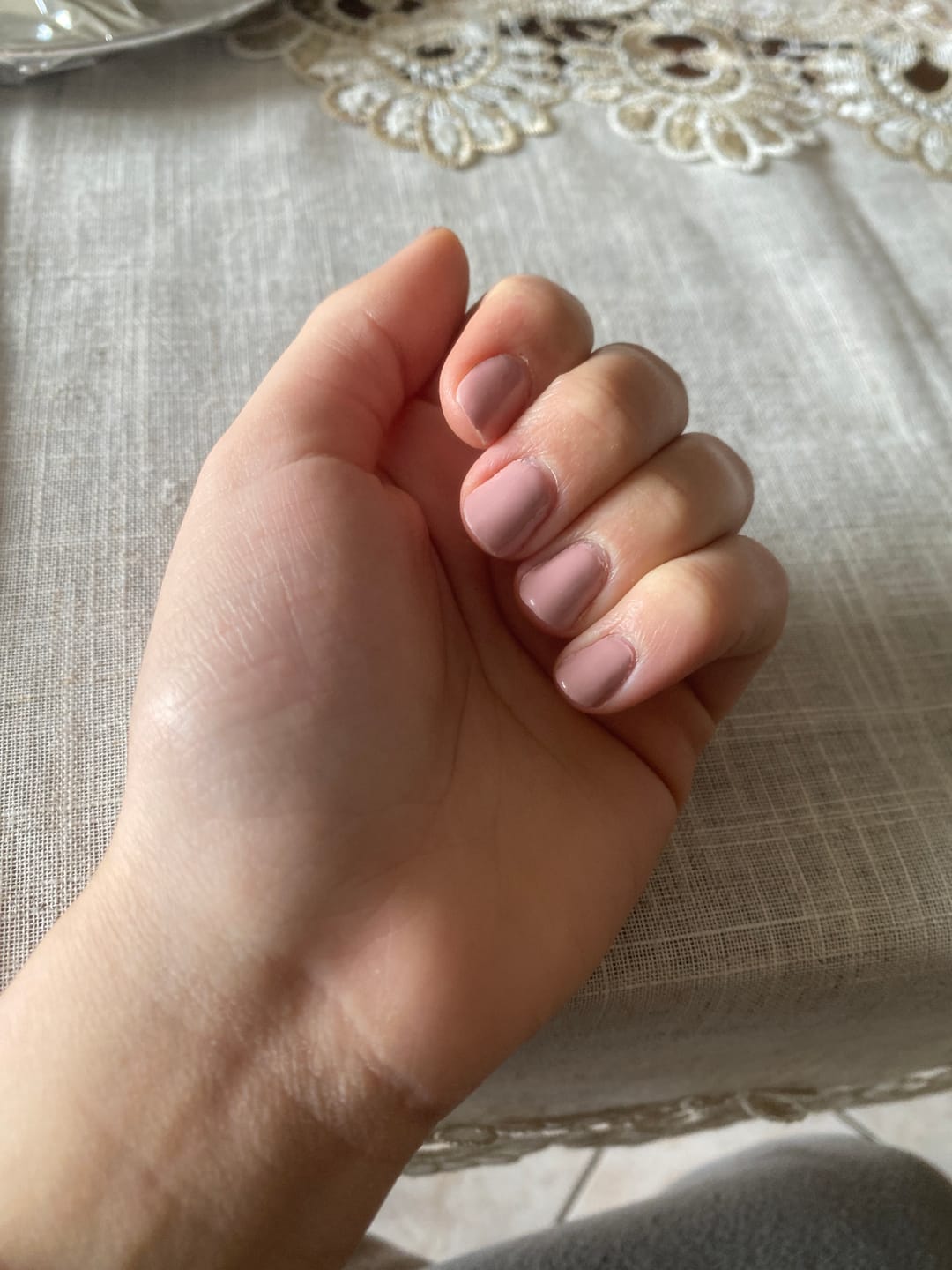 Customer photo review of LCI Combo Pack: Base Coat 10 ml + Top Coat 10 ml