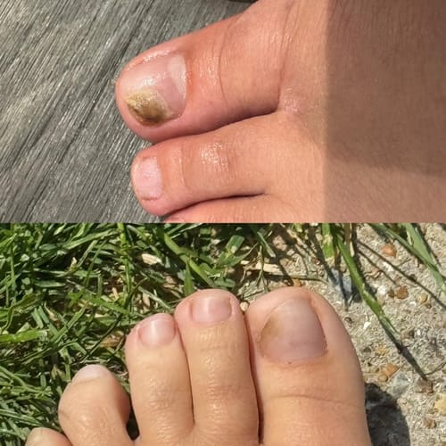 Customer photo review of VitaeCharm NailShield Anti-Fungal Stick