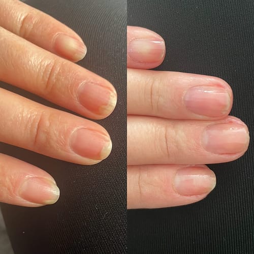 Customer photo review of VitaeCharm NailShield Anti-Fungal Stick