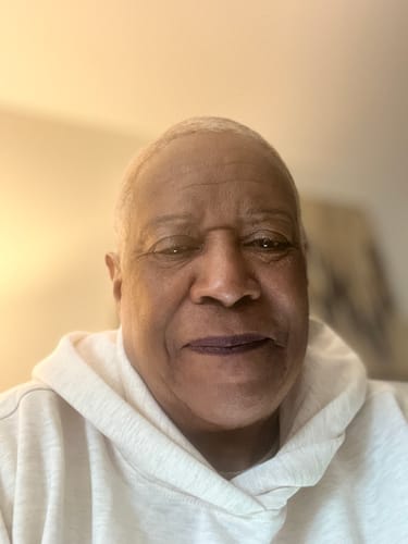 Customer photo review of Transform Wrinkles, Fine Lines, And Tired Creases Naturally