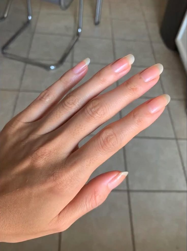 Customer photo review of עט השמן של NOVELA לשיקום הציפורן והעור