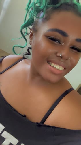 Customer photo review of Transform Wrinkles, Fine Lines, And Tired Creases Naturally