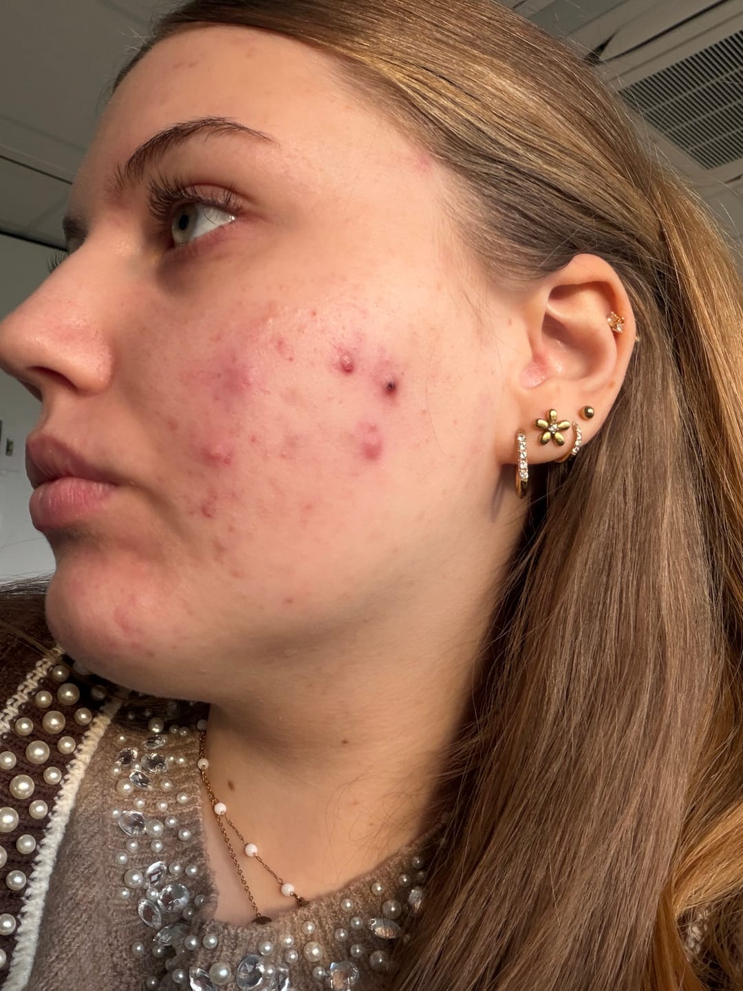 Customer photo review of HYPER G[L]O - Renewing Night Serum