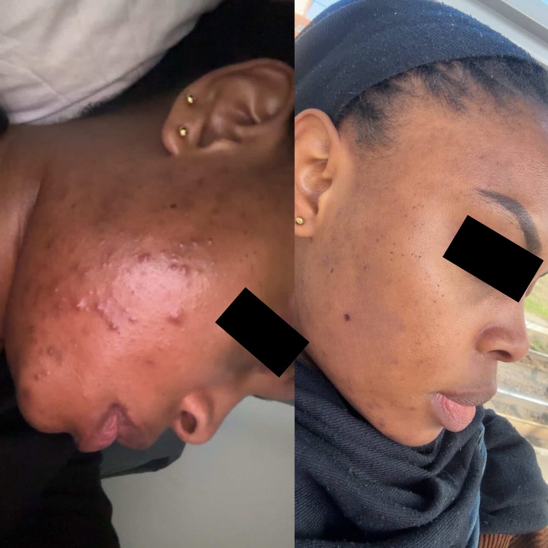 Customer photo review of Sérum Anti-Imperfections