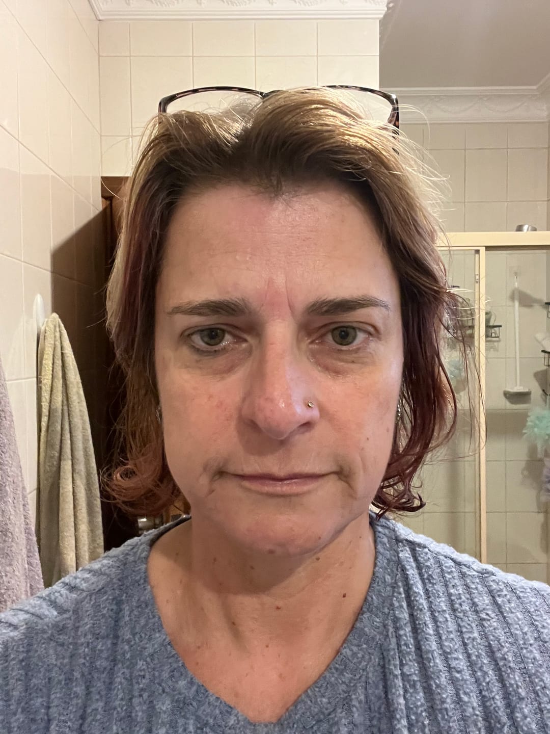 Customer photo review of The Repair Duo — GHK-Cu + PDRN Serum