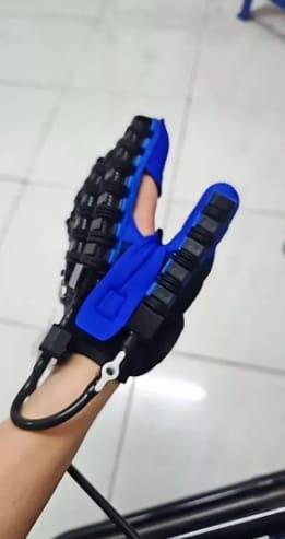 Customer photo review of ReGrip™ | Rehabilitation Glove