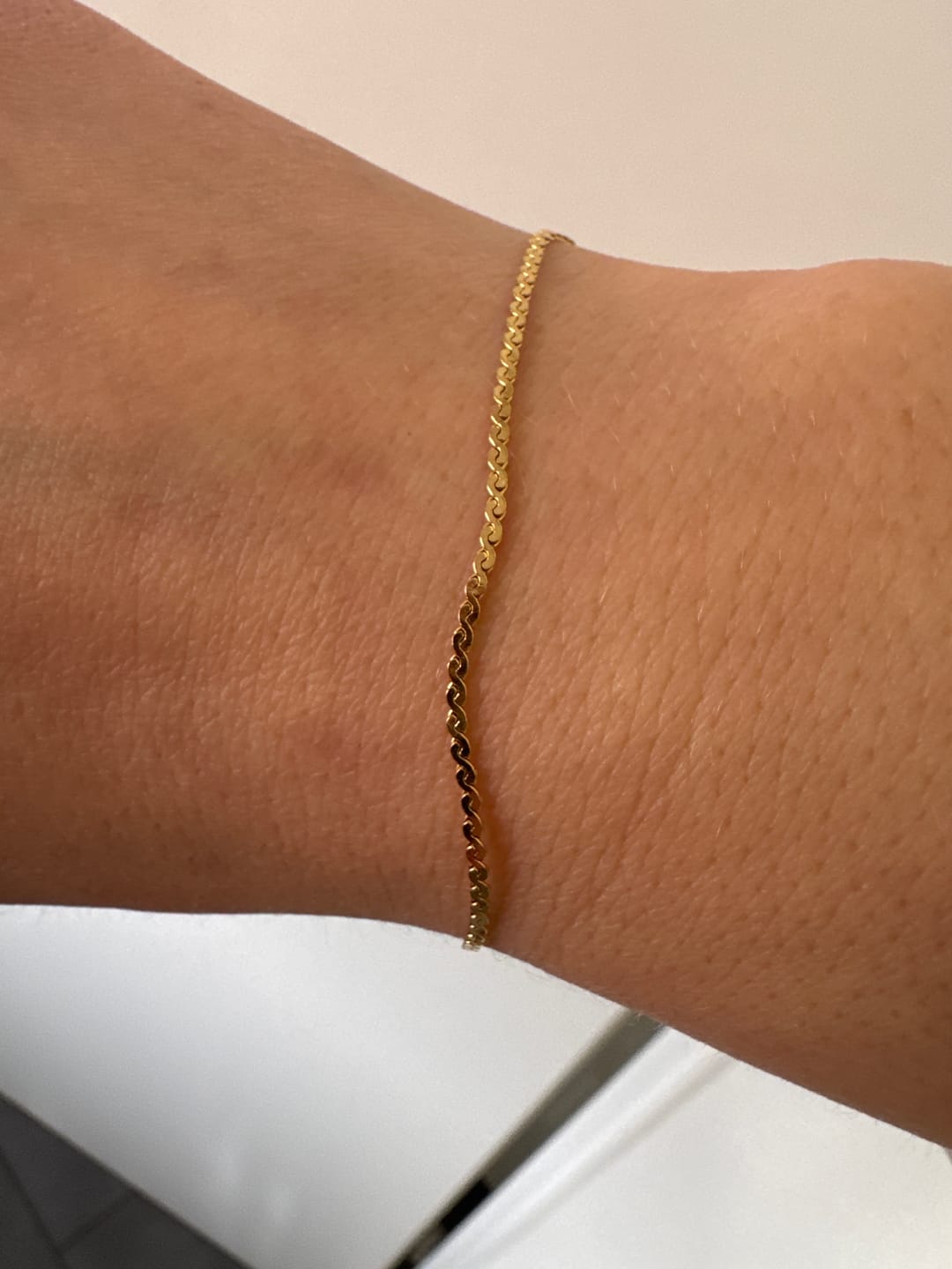 Customer photo review of Permanent Armband - dein everbond in Köln