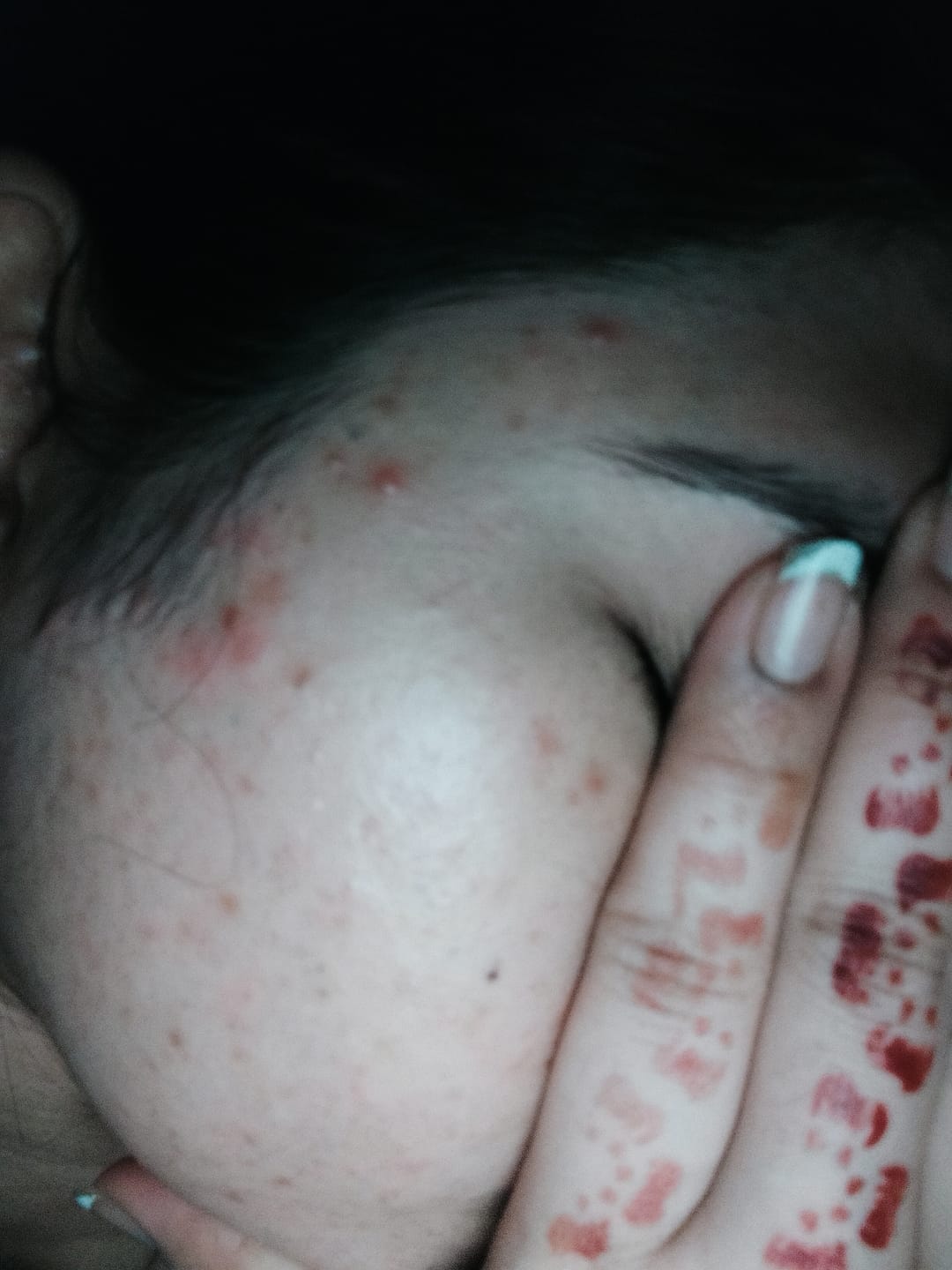 Customer photo review of Gluta Dual Bright Serum