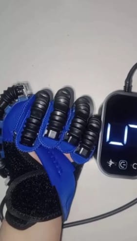 Customer photo review of ReGrip™ | Rehabilitation Glove