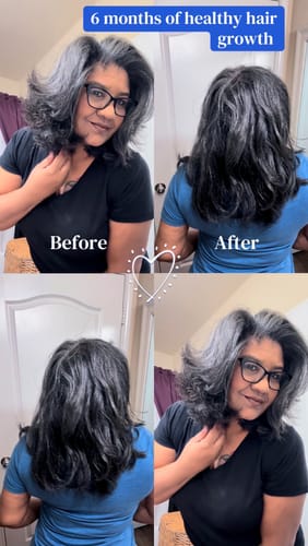 Customer photo review of India’s Secret Ancient Ayurvedic Hair Follicle Elixir (5 sizes)