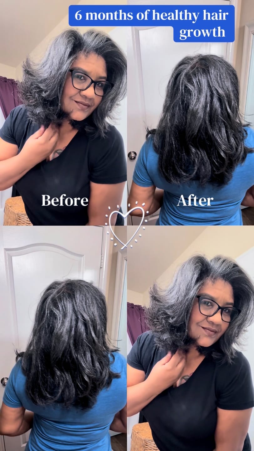 Customer photo review of India’s Secret Ancient Ayurvedic Hair Follicle Elixir (5 sizes)