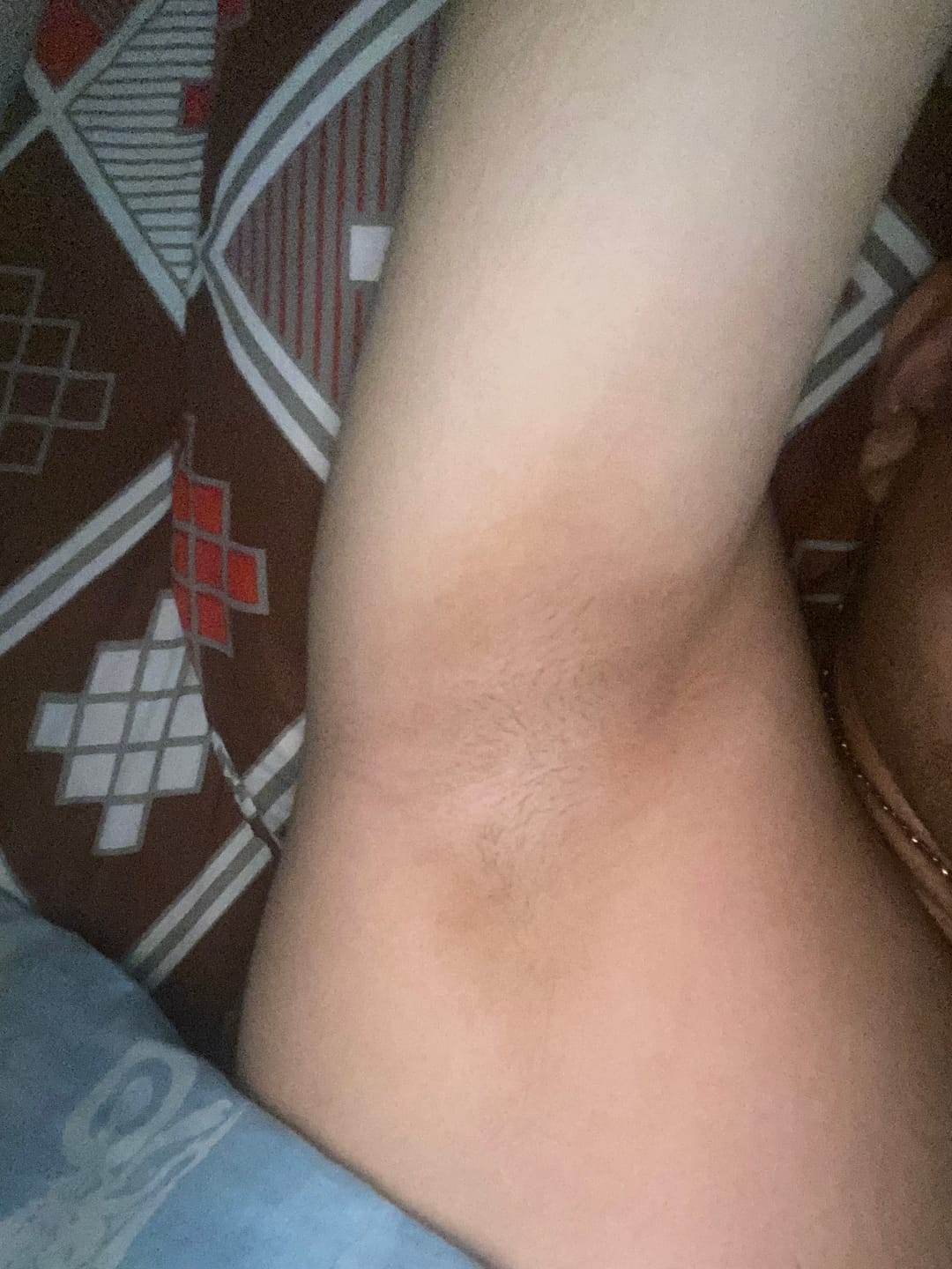 Customer photo review of Tónico Anti-Imperfecciones