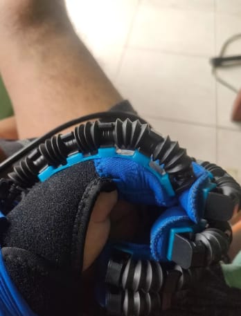 Customer photo review of ReGrip™ | Rehabilitation Glove