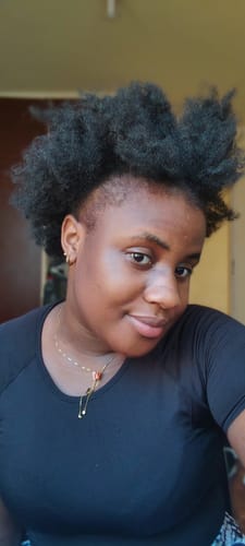 Customer photo review of Minoxidil 5% SOLUTION, 3x60ml pack