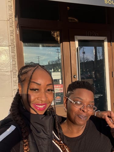 Customer photo review of Transform Wrinkles, Fine Lines, And Tired Creases Naturally