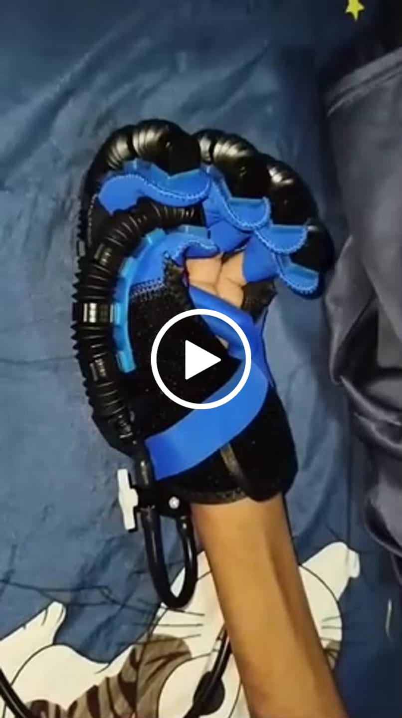 Customer video review of ReGrip™ | Rehabilitation Glove