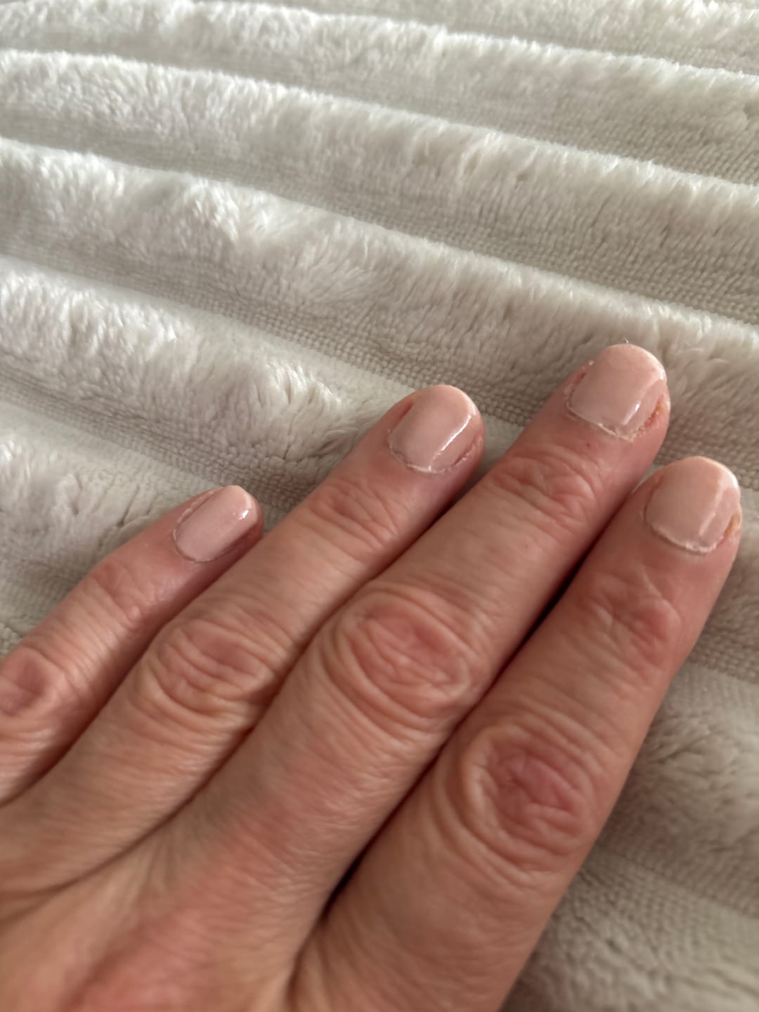 Customer photo review of Verwijderkom