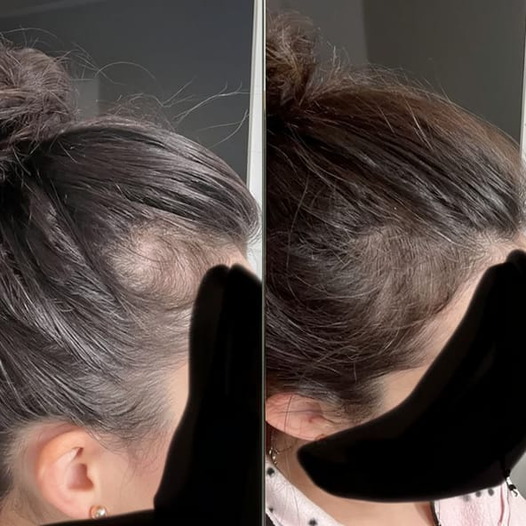 Customer photo review of Sérum de croissance pour cheveux (1 mois)