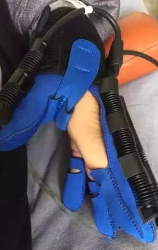 Customer photo review of ReGrip™ | Rehabilitation Glove