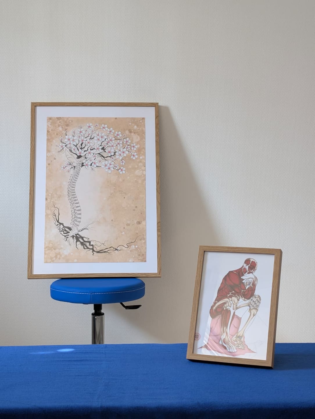 Customer photo review of Écorché anatomique du penseur de Rodin