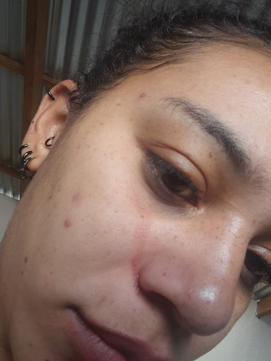 Customer photo review of Tónico Anti-Imperfecciones
