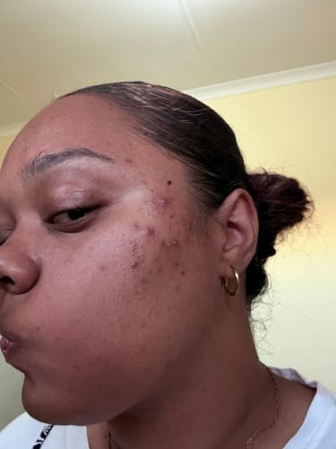 Customer photo review of Super Glaze