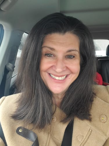 Customer photo review of Transform Wrinkles, Fine Lines, And Tired Creases Naturally