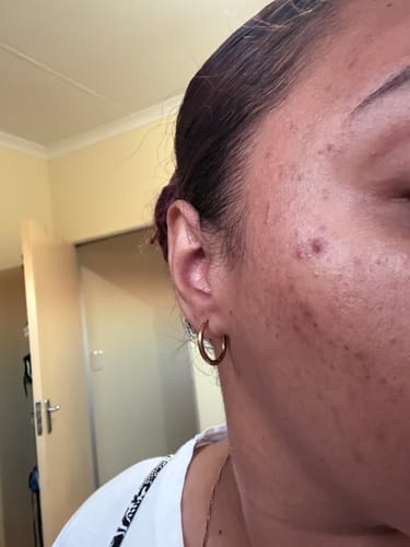 Customer photo review of Super Glaze