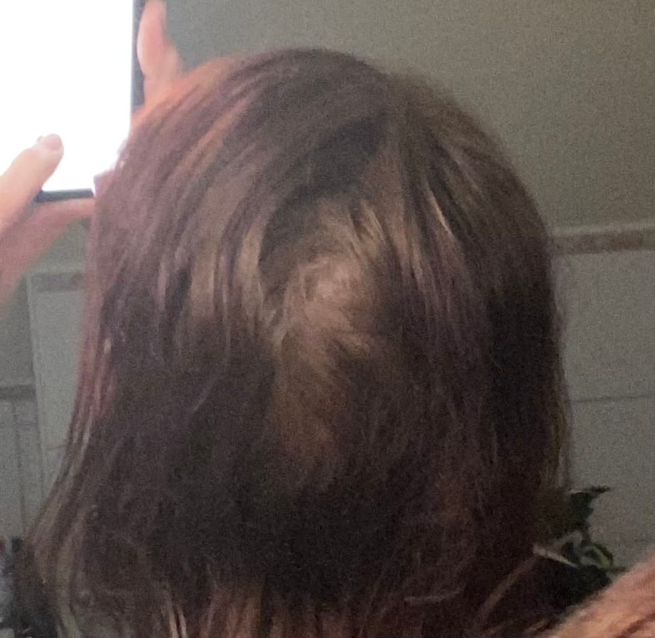 Customer photo review of Streuhaar Applikator von IMPERIO®