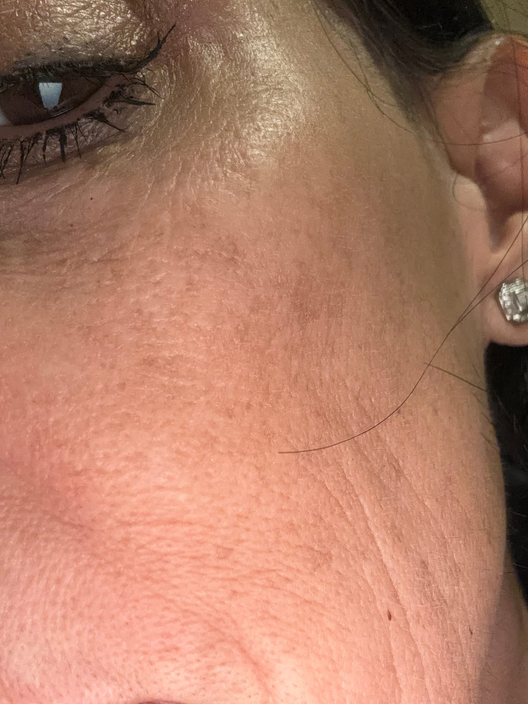 Customer photo review of Micro Infusion Patches