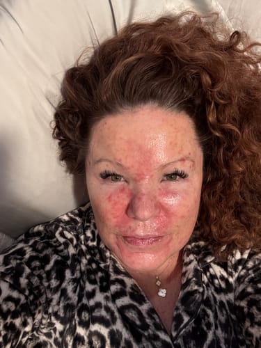 Customer photo review of Transform Wrinkles, Fine Lines, And Tired Creases Naturally