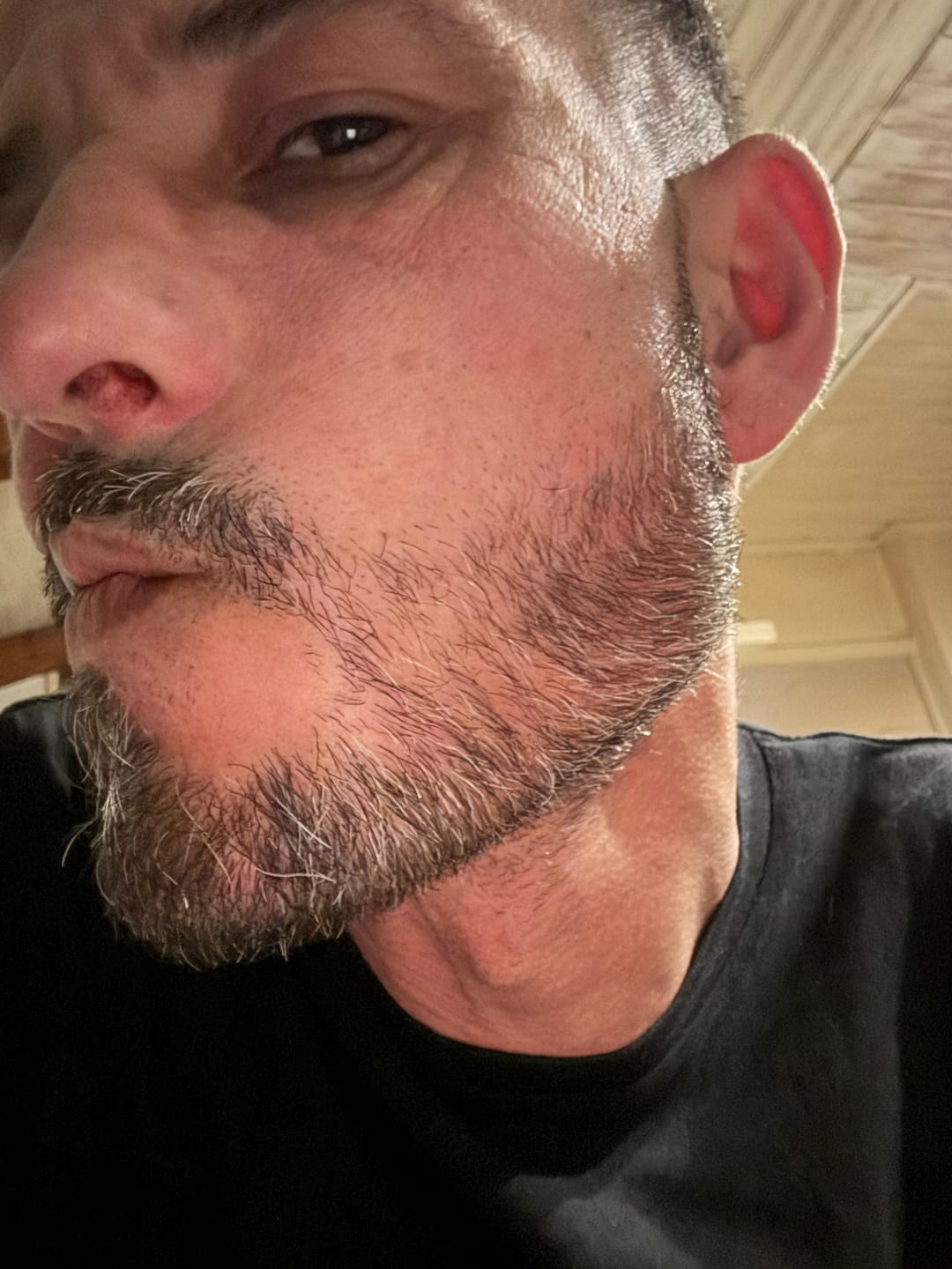 Customer photo review of Activator Serum | Booster Croissance de barbe