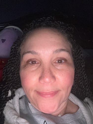 Customer photo review of Transform Wrinkles, Fine Lines, And Tired Creases Naturally