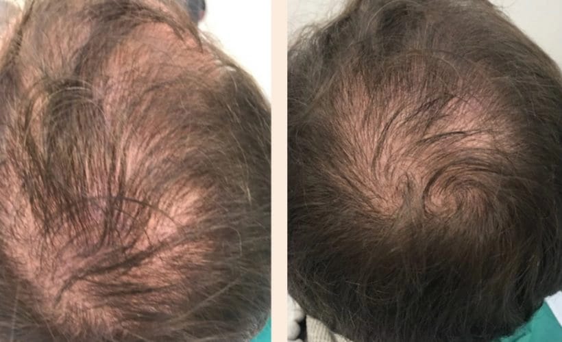 Customer photo review of Formule Deluxe