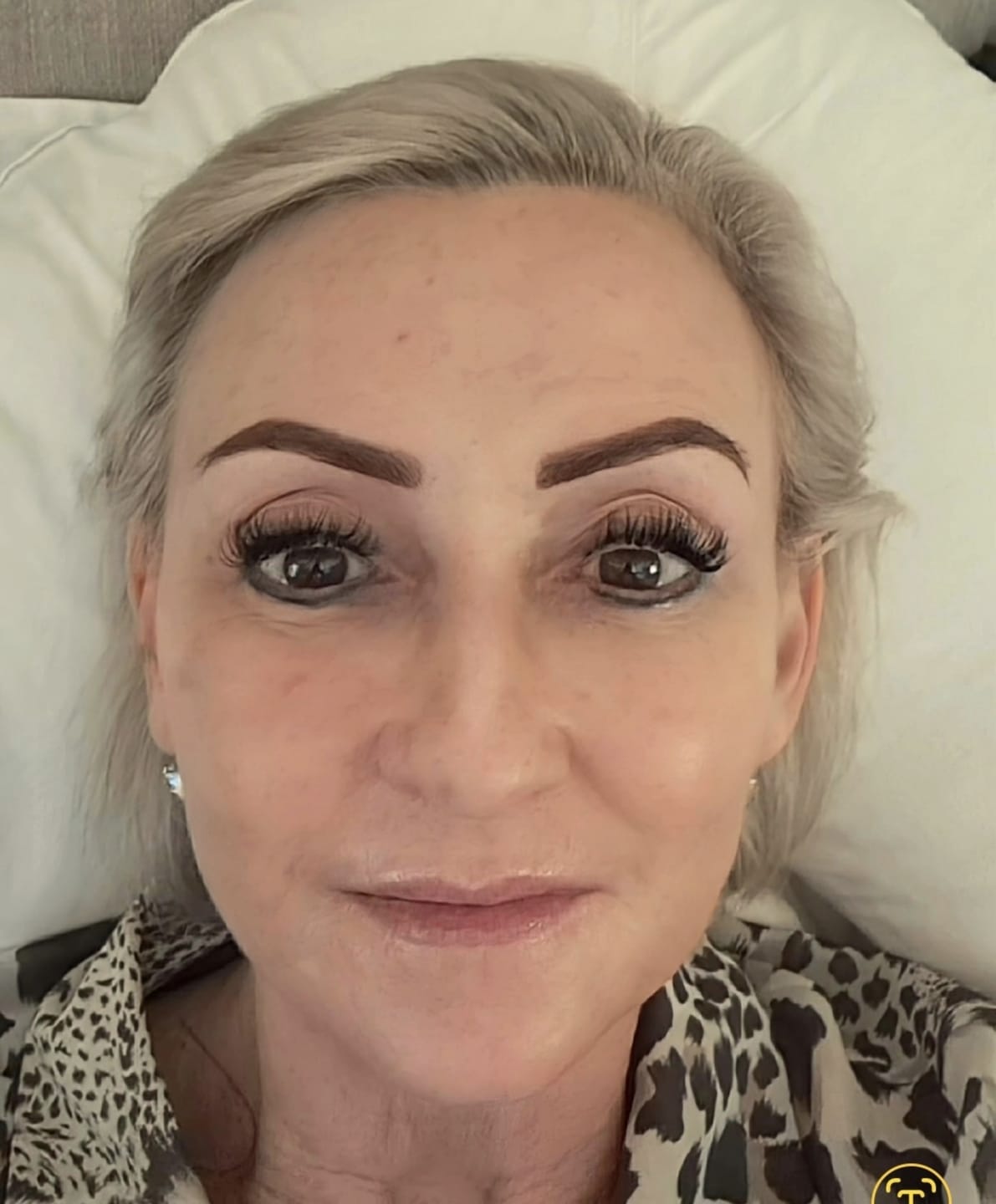 Customer photo review of Glow + Grow Hair Growth Collagen