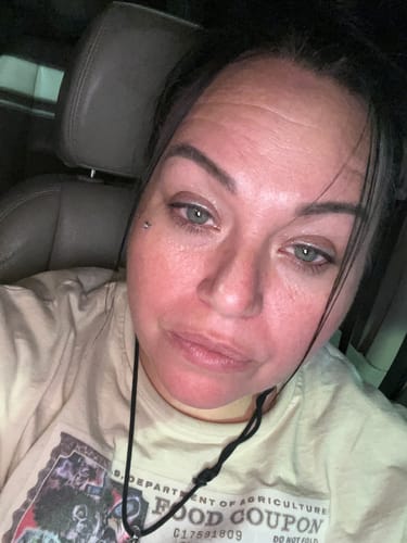 Customer photo review of Transform Wrinkles, Fine Lines, And Tired Creases Naturally