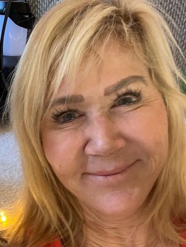 Customer photo review of HA Serum