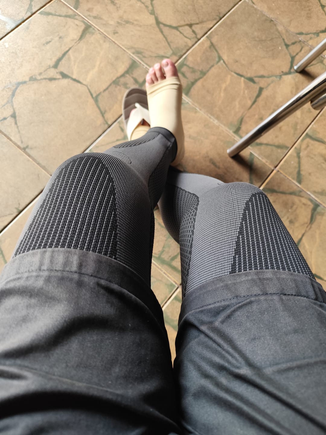 Customer photo review of Joelheira de Compressão LongBrace
