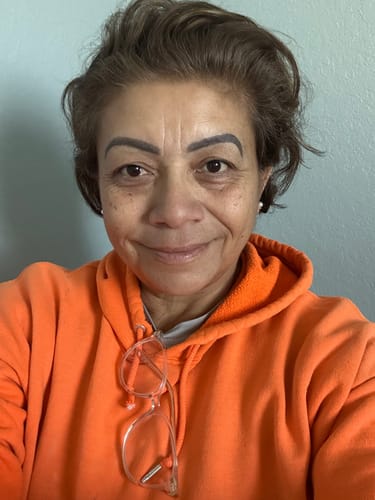 Customer's before photo showing her face prior to using the Seranova Micro Infusion System.