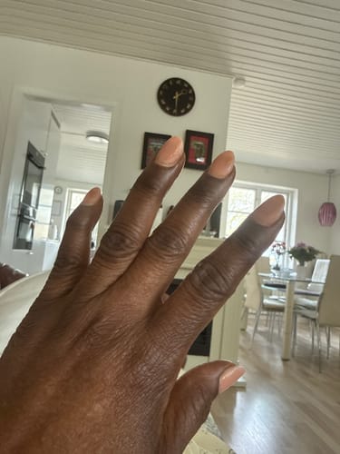 Customer photo review of Carotis Skin Brightening Gel With Vitamin A 30g / 1 fl oz