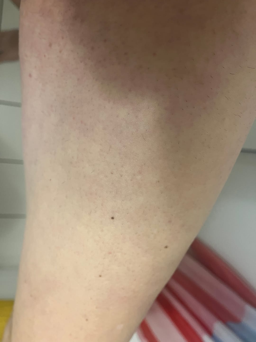 Customer photo review of Bumzzy Butt Shaver 2.0