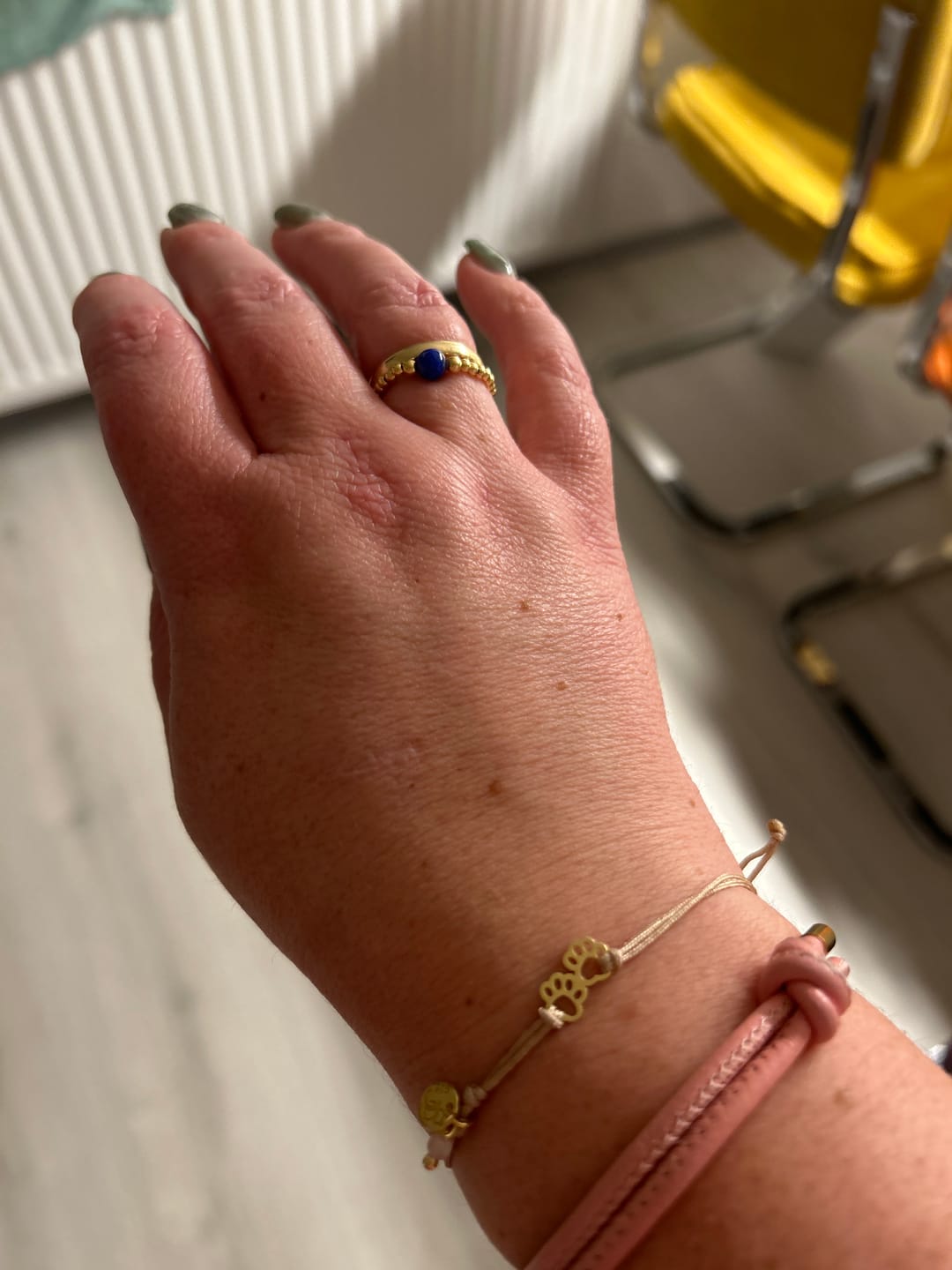 Customer photo review of Pawsitive Armband