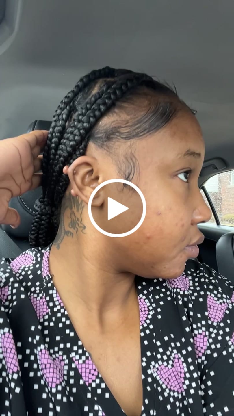 Customer video review of LIMITED EDITION: Jolie’s Mini Full Body & Face Brightening Kit/ Acne Kit