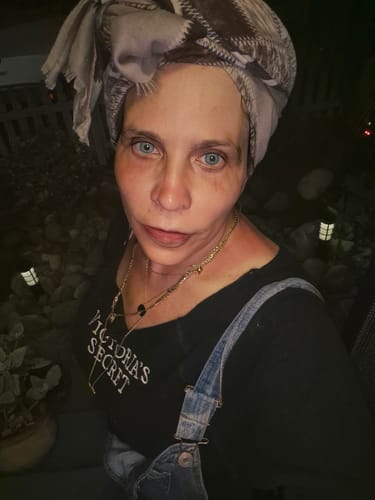 Close-up of a reviewer's face showing their skin after treatments with the Micro Infusion System.