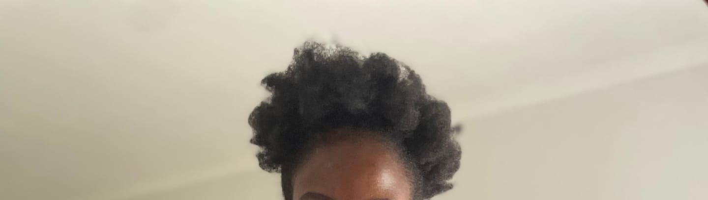Customer photo review of Root Stimulating Serum (50ml) - Minoxidil