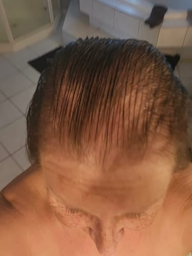 Close-up of a reviewer's wet hair and scalp, showing the results of using the Scalp Massager.